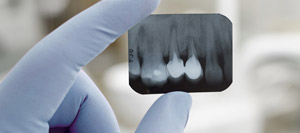 Sidebar Dental Photo